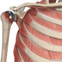 Revision Shoulder Replacement