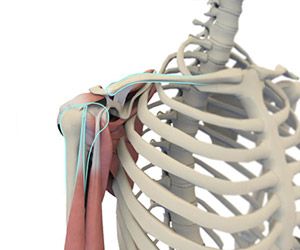 Shoulder Joint Replacement