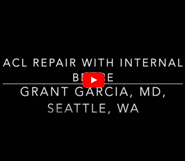 Dr. Garcia’s 2023 technique for ACL repair with internal brace