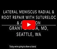 ACL with lateral meniscal radial repair with the new Sutureloc
