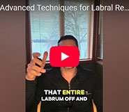 Advanced Techniques for Labral Repairs
