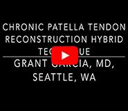 Chronic Patella Tendon Reconstruction with Achilles allograft and Hamstring Autograft
