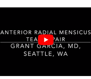 Complex anterior meniscus repair