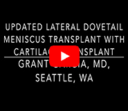 Dr. Garcia’s 2026 lateral meniscus transplant video