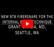 Dr. Garcia demonstrates the new Arthrex BTB Fibersnare