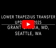 Dr. Garcia’s updated lower trapezius transfer technique