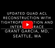 Dr. Garcia’s Updated Quad ACL Reconstruction Technique