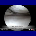 Dr. Garcia demonstrates his innovative technique for arthroscopic meniscus root repairs.