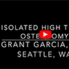 Check out Dr. Garcia’s technique for high tibial osteotomy in a young
active patient wanting to return to high impact activities.
