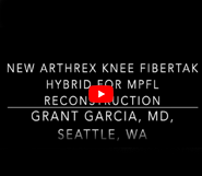 The first MPFL reconstruction with the new knotless knee fibertak in Washington State