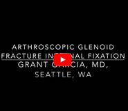 New Glenoid Fracture Repair