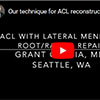 Our technique for ACL reconstruction with a lateral meniscus root
repair.