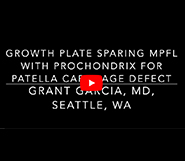Pediatric MPFL Reconstruction with Prochondrix for Cartilage Repair