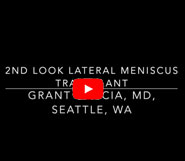 Second look after lateral meniscus transplantn