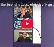 The Surprising Cause of Hook of Hamate Fractures