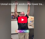 Unreal results 8 weeks after lower trapezius transfer