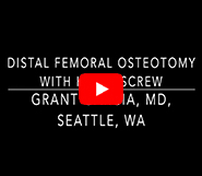 Updated 2026 Distal Femoral Osteotomy Technique