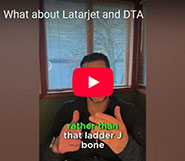 What about Latarjet and DTA