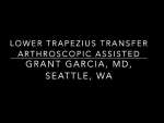 Check out Dr. Garcia’s technique for lower trapezius transfer, one of the first performe...
