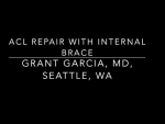 Check out our new ACL Repair (Preservation) technique to help patients get back from ACL i...