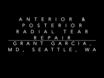 Dr. Garcia demonstrates his complex repair of a rare anterior and posterior radial meniscu...