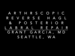 Dr. Garcia demonstrates his complex technique for arthroscopic HAGL repair