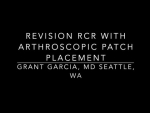 Dr. Garcia demonstrates his cutting edge technique for arthroscopic patch augmentation for...