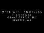 Dr. Garcia demonstrates his new innovative technique for MPFL reconstruction.