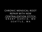 Dr Garcia demonstrates his new meniscal extrusion technique to further improve meniscus ro...