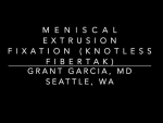 Dr. Garcia demonstrates his new technique to improve meniscus root repairs using a knotles...