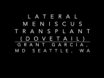 Dr. Garcia demonstrates his technique for a lateral meniscus transplant using the dovetail...