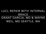 Dr. Garcia demonstrates his technique for acute elbow dislocations: LUCL repair with inter...