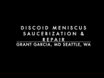 Dr. Garcia demonstrates his technique for discoid meniscus repair in a young active patien...