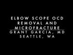 Dr. Garcia demonstrates his technique for elbow OCD removal and microfracture for high lev...