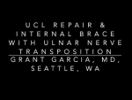 Dr. Garcia demonstrates is innovative technique for UCL (Tommy John) repair with Internal....