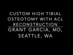Dr. Garcia’s technique for a High tibial osteotomy with an ACL reconstruction using a 3D...