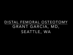 Dr. Garcia’s technique for distal femoral osteotomy