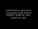 Horizontal meniscus repair in a high level soccer player