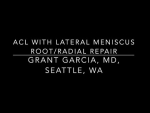 Our technique for ACL reconstruction with a lateral meniscus root repair.