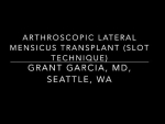 Step by step surgical video for a lateral meniscus transplant.